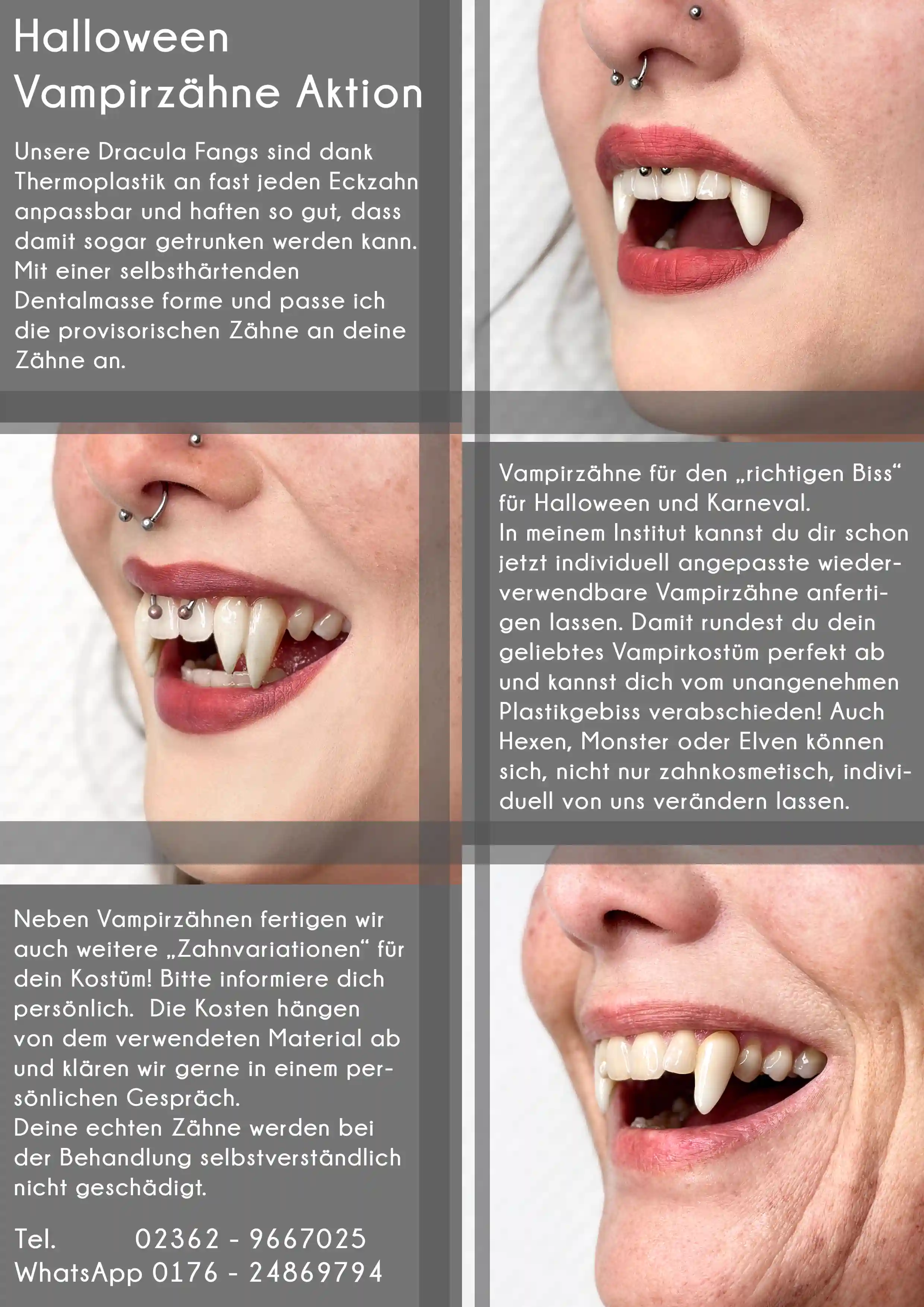 Halloween Vampirzähne Aktion – individuell angepasste, wiederverwendbare Fangs aus Thermoplastik
